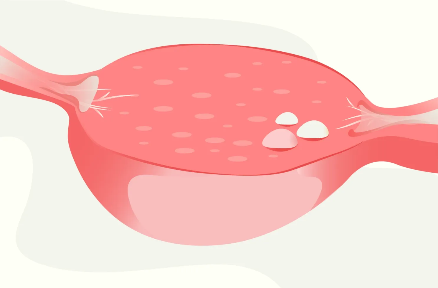 primary ovarian insufficiency