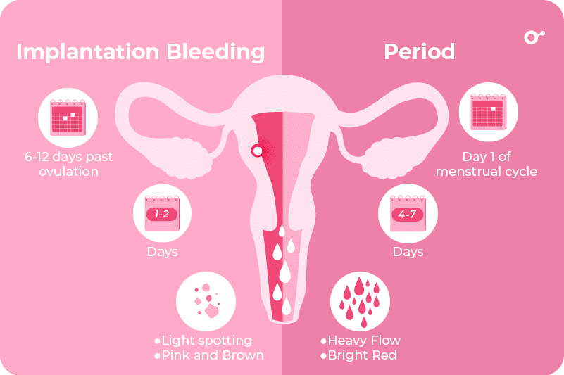 Brown Implantation Bleeding - Trying to Conceive, Forums
