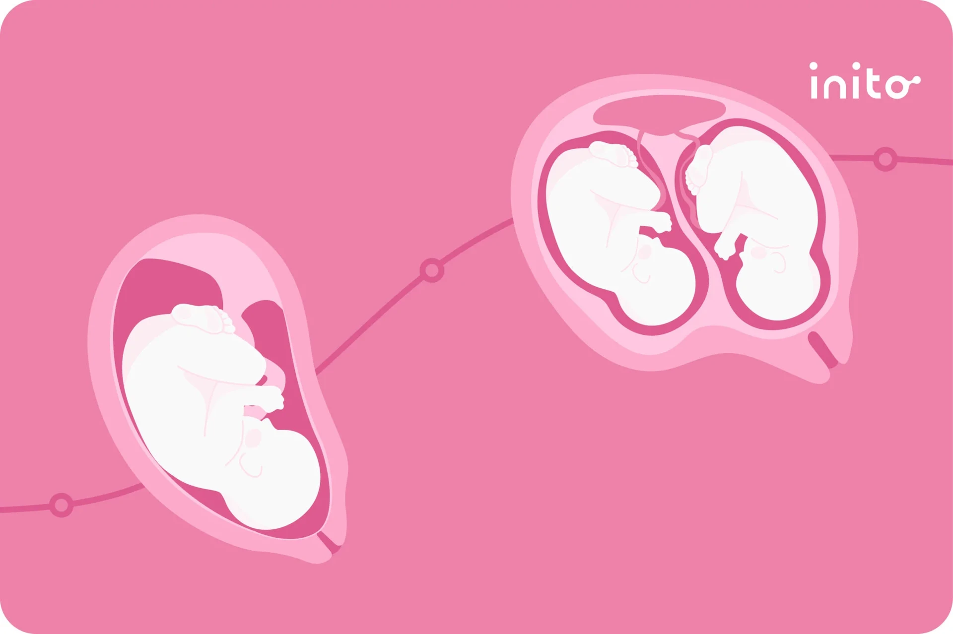 twins hcg levels