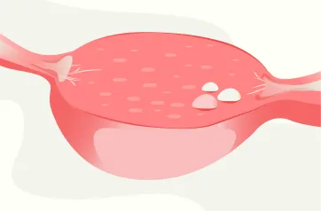 primary ovarian insufficiency