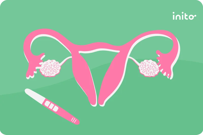 PCOS and pregnancy