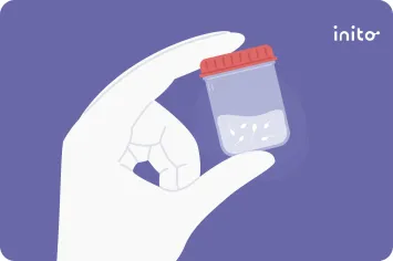 Semen (Sperm) Watery