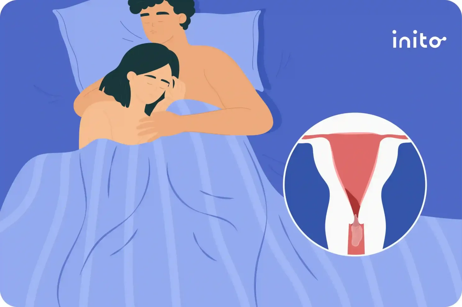 Sex After Miscarriage