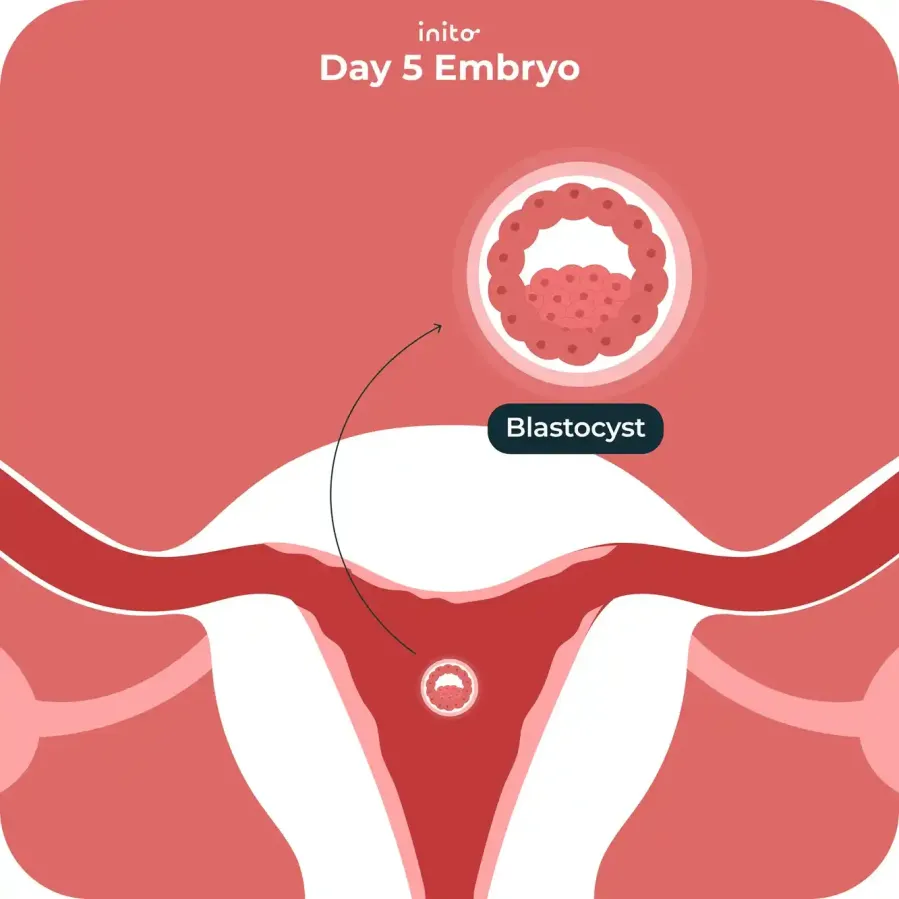 Day 5 embryo Day 5 embryo