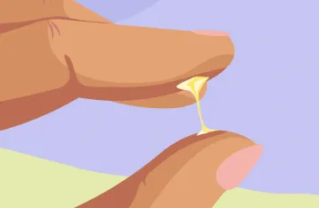 Yellow Discharge Before Period