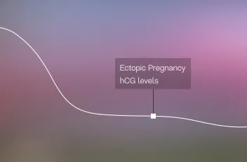 Ectopic Pregnancy hCG Levels