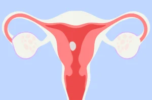 How common is a missed miscarriage