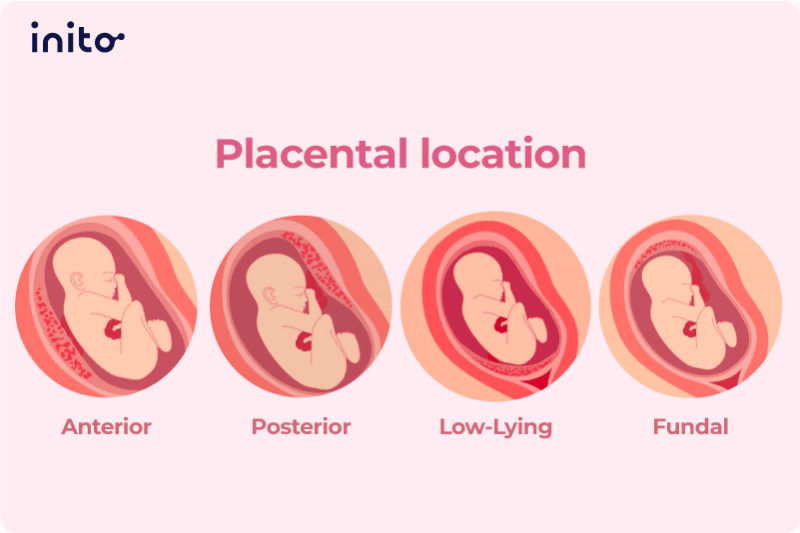 Placental location