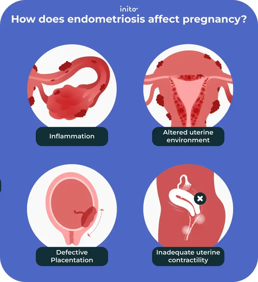 How does endometriosis affect pregnancy